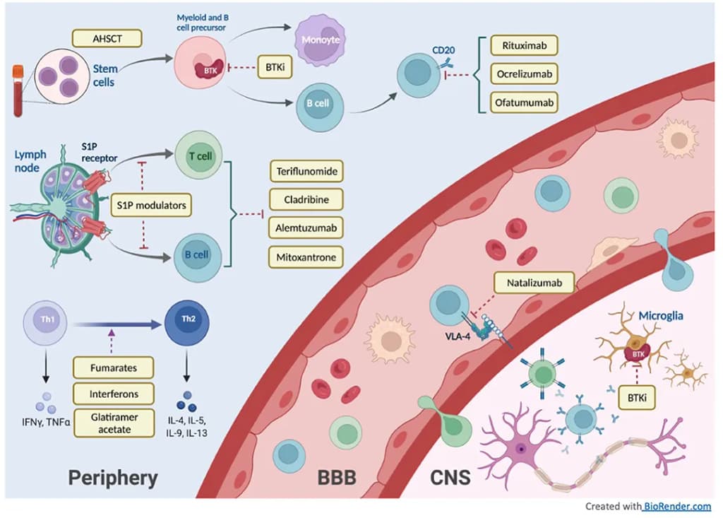 Multiple Sclerosis treatment