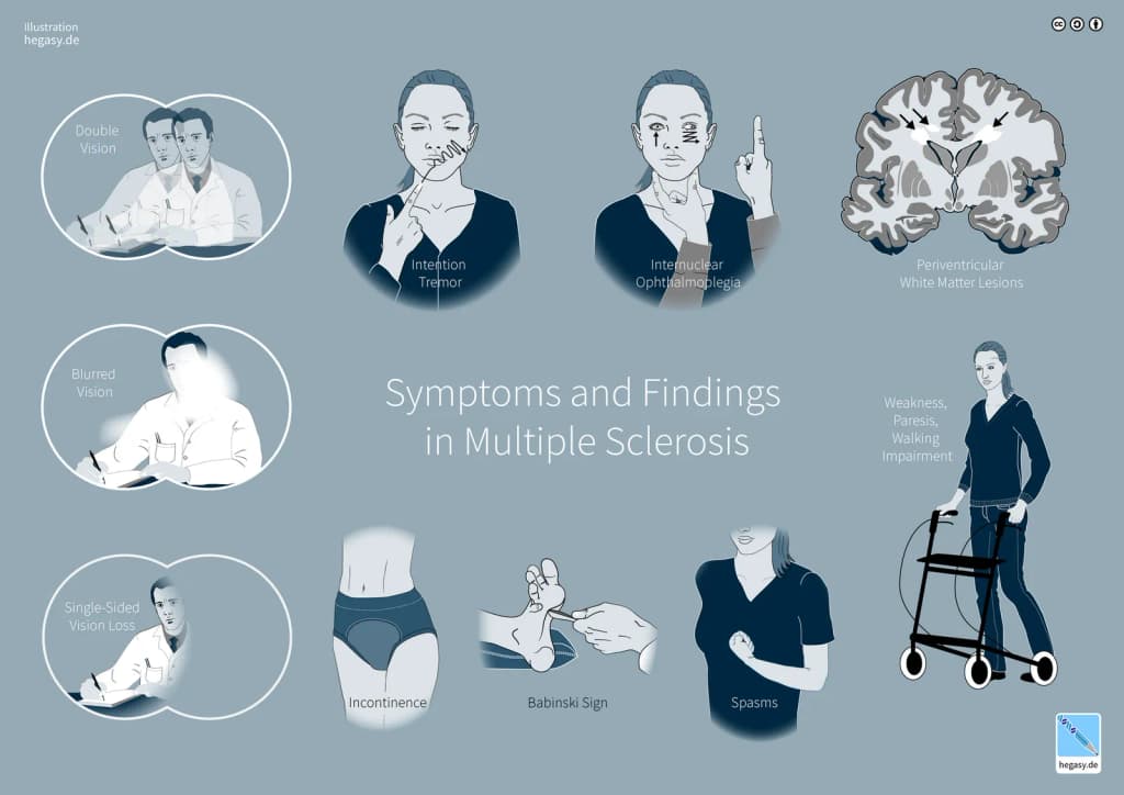 Symptoms and Findings in Multiple Sclerosis