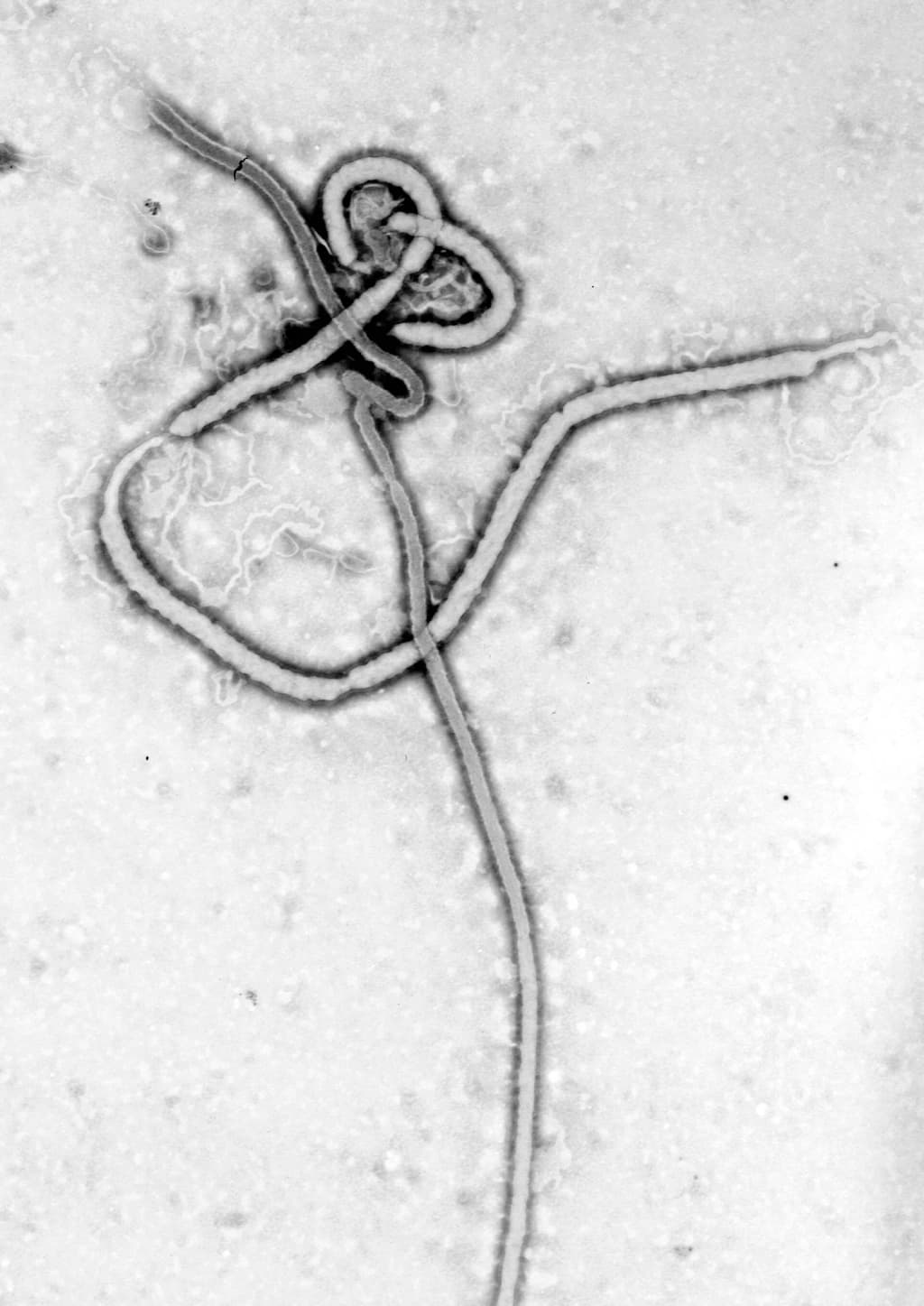 Transmission Electron Micrograph of the Ebola Virus. Hemorrhagic Fever, RNA Virus.