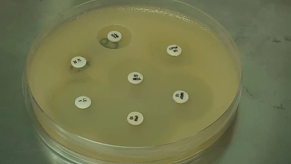 The results of these tests are crucial for understanding the best treatment options for infections caused by Acinetobacter, especially given its resistance to m