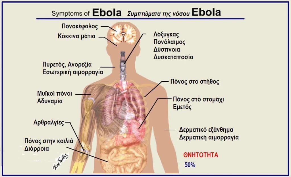 Ebola Symptoms