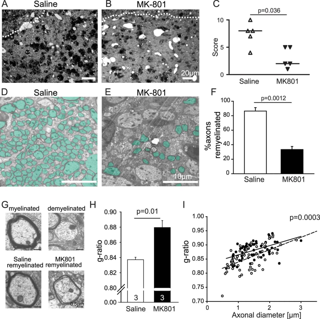 Figure 8. Remyelination is dependent on NMDA receptor activation. (A–B) Semithin sections of lesioned caudal cerebellar peduncle (CCP), 21 d postlesion, infused